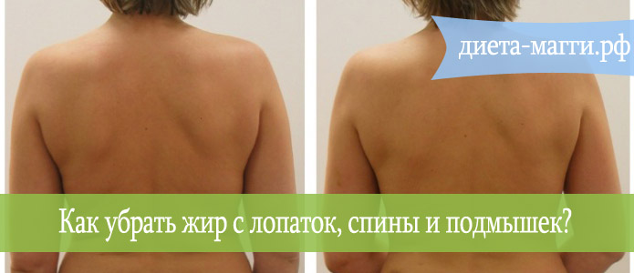 Как убрать жир с лопаток, спины и подмышек - домашние упражнения